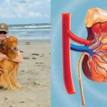 "Kryptonit" nie pomógł. Brad Arnold przegrywa walkę z cichym zabójcą. Medyczna analiza tragedii