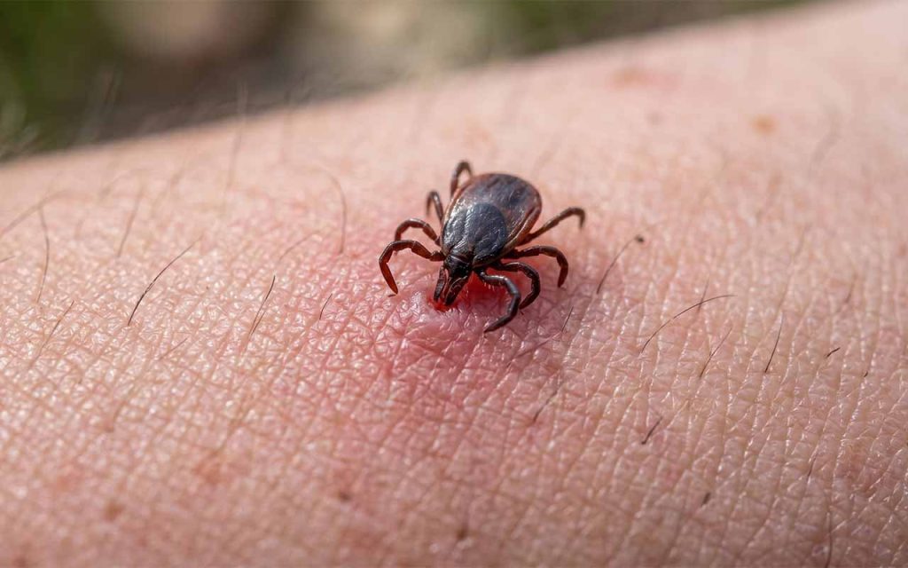 Zdjęcie: kleszcz na ludzkim przedramieniu w zbliżeniu makro, widać szczegóły aparatu gębowego